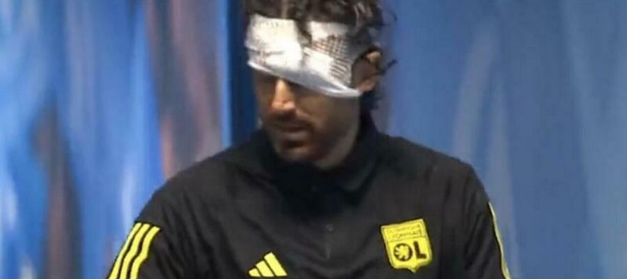 Lyon director Vincent Ponsot has confirmed Grosso risked losing his left eye, after a projectile hit him as the bus was making its way into the Velodrome.